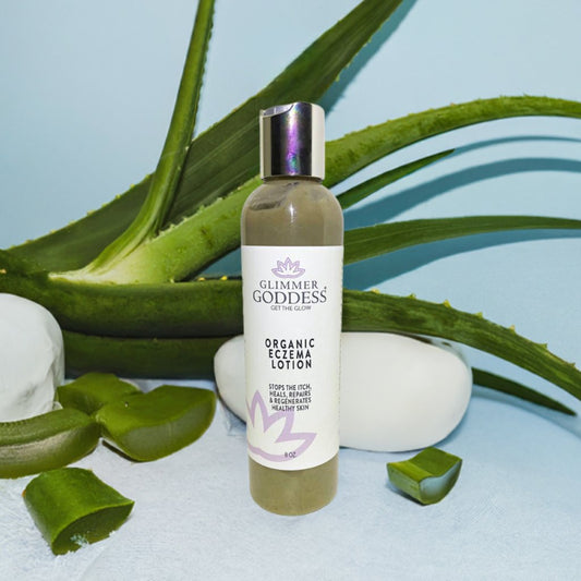 Organic Eczema Lotion – Soothing Relief & Skin Healing